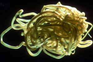 Study sheds light on parasite that causes river blindness