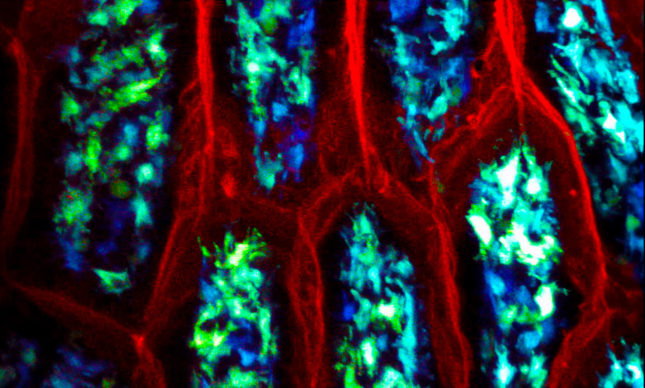 lp-dcs-sampling-infected-mouse-intestine1290