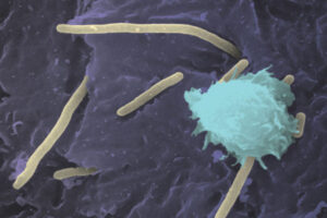 Aggressive UTI bacteria hijack copper, feed off it