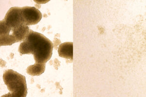 Zika virus kills brain cancer stem cells