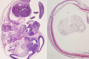 Antibody protects against both zika and dengue, mouse study shows