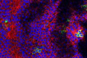 Like Zika, West Nile virus causes fetal brain damage, death in mice. Jonathon Miner, MD, PhD, with help from Michael Diamond, MD, PhD, infected human placentas with one of four viruses or zika virus.