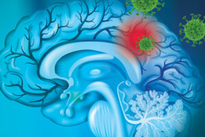 Cancer weapon: Zika virus kills glioblastoma stem cells in early research