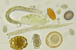 Gut microbes influence severity of intestinal parasitic infections