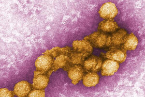 Senior author, Robyn Klein, MD, PhD, Memory loss from West Nile virus may be preventable