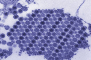 Senior author, Mike Diamond, MD, PhD, Why chikungunya, other arthritis-causing viruses target joints