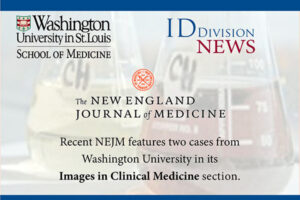 NEJM features two WashU ID cases, one cited in the Washington Post