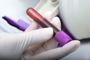 Michael Diamond, MD, PhD and Daved Fremont, PhD, co-inventors of Zika diagnostic test granted market authorization by FDA