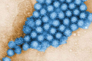 Gut microbes alter characteristics of norovirus infection