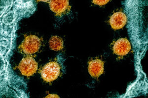 ID-CRU launches novel clinical trial to test multiple therapeutics to treat COVID-19