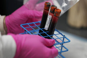 Matifadza Hlatshwayo Davis, M.D., MPH, shares her opinion with Newsweek “Rushing a COVID-19 Vaccine Risks Leaving Behind the People Most at Risk”