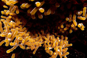 Jennifer Philips and colleagues identify possible new method to assess severity of TB infection