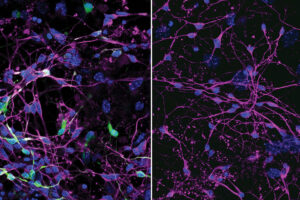 Discovery of viral entry routes into cells points to future prevention, treatment strategies