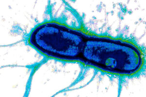 Researchers find a common weakness in major gut pathogens