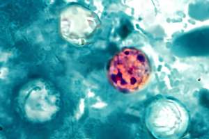 Reducing the risk of cyclosporiasis infection