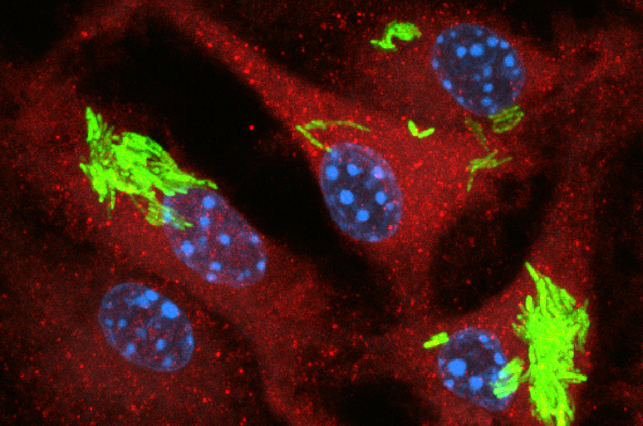 philips-tb-inf-macrophage-red-blue-green1290